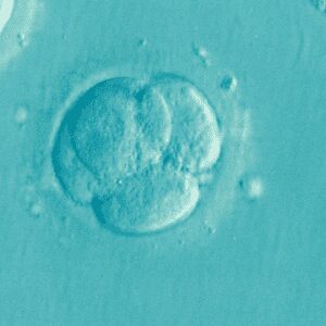 Why I became a fertility dietitian Why I became a fertility dietitian